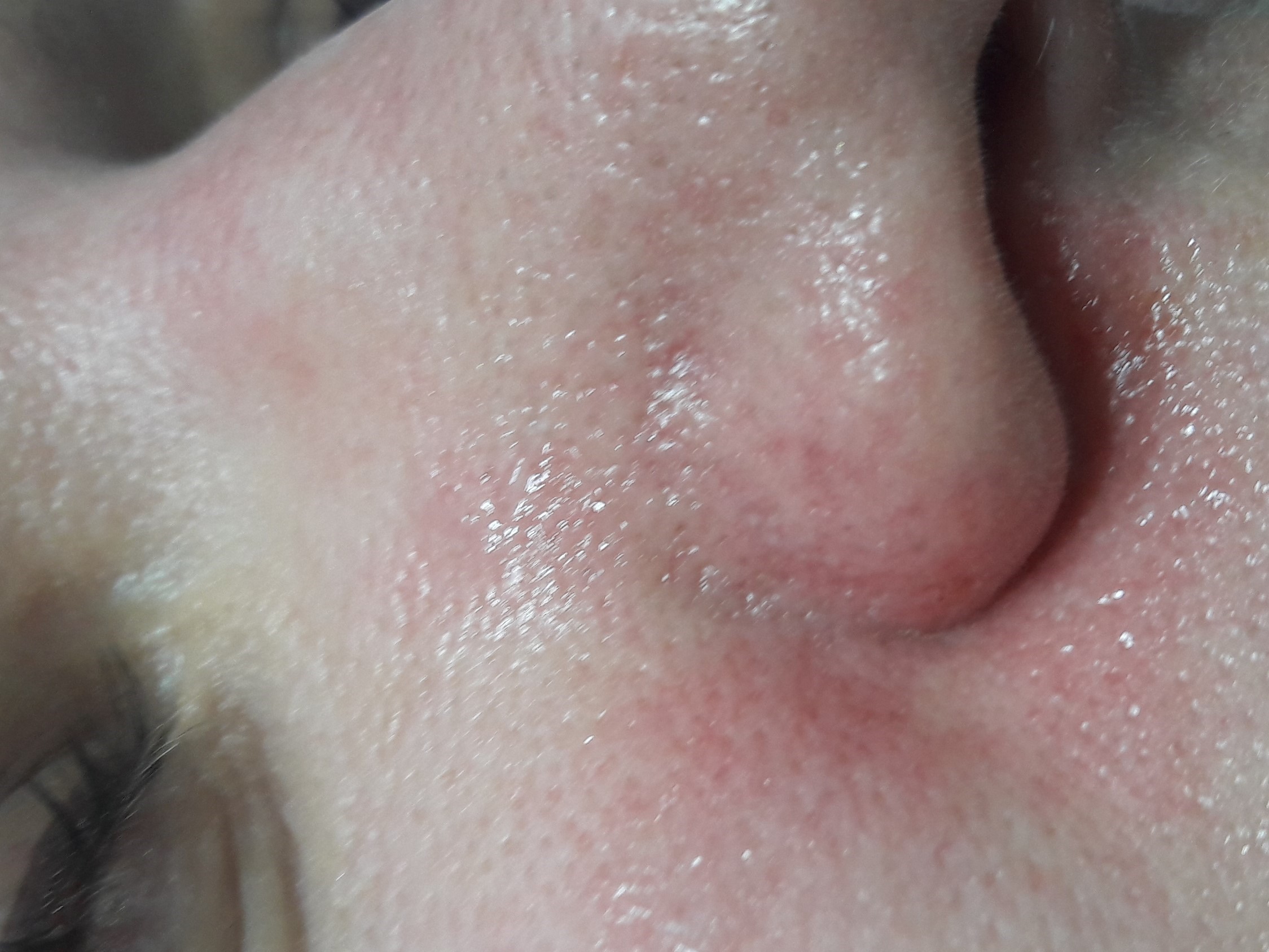 close up image of a nose